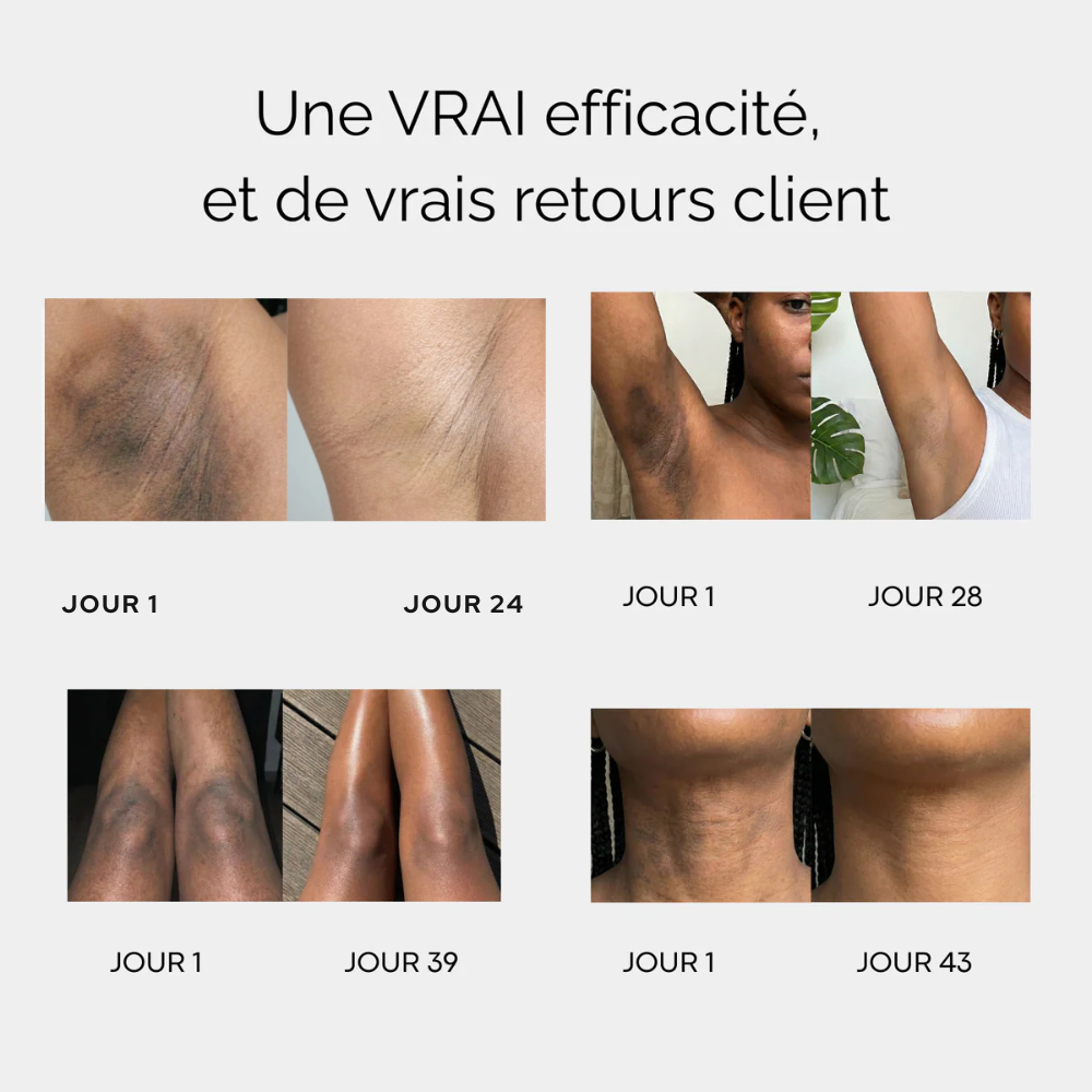 Ciloria™ - Savon au Curcuma et à l'acide kojique